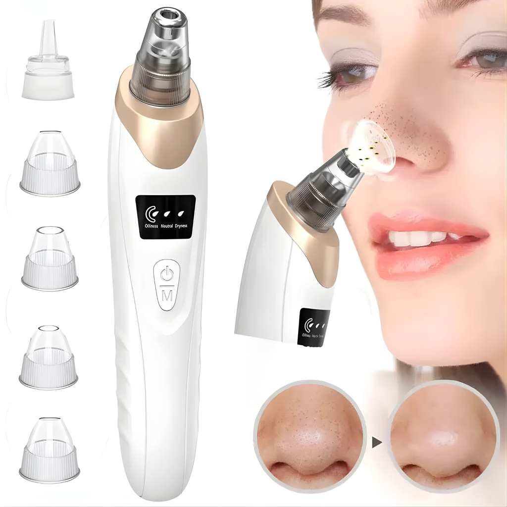 ZYLO Electric Blackhead Remover for Clear & Smooth Skin