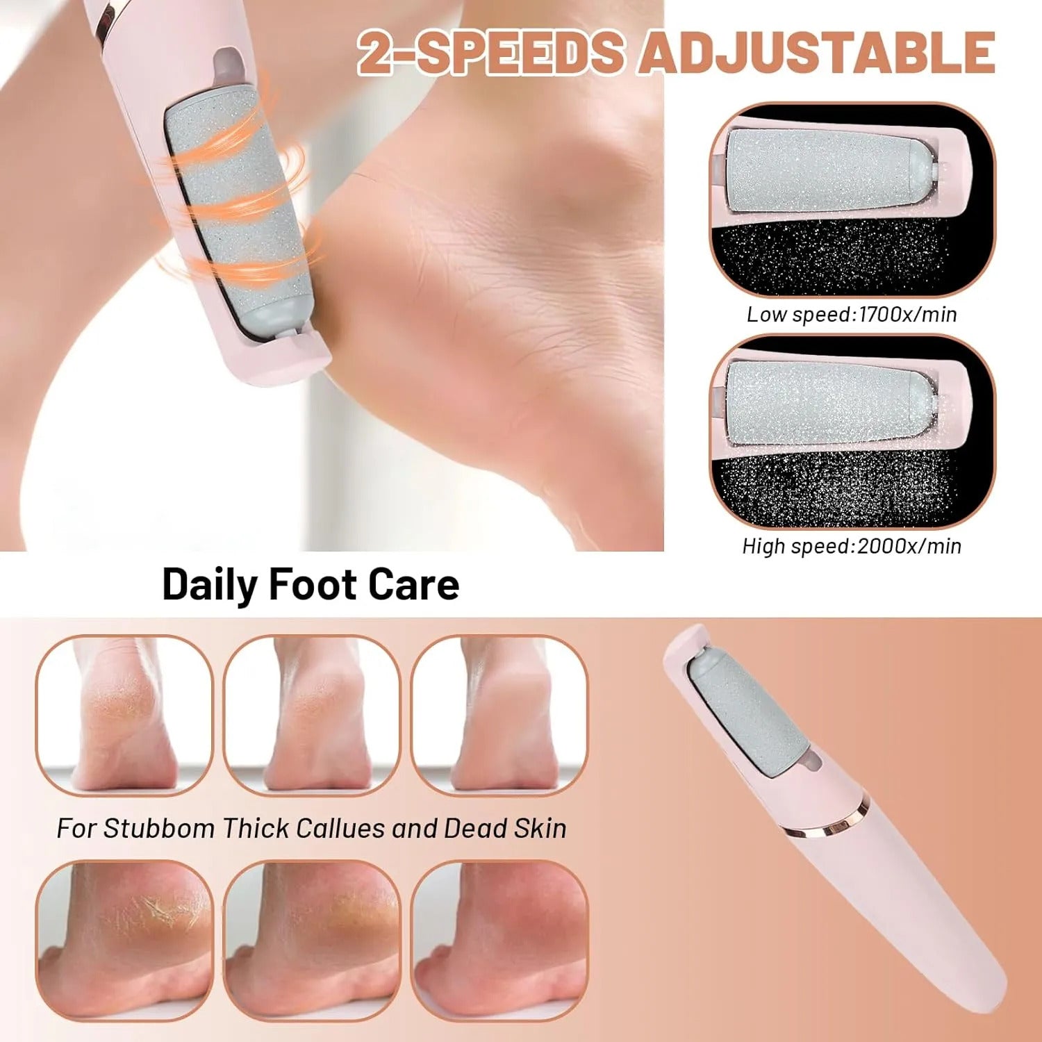 Zylo Electric Foot Callus Remover for Smooth and Soft Heels